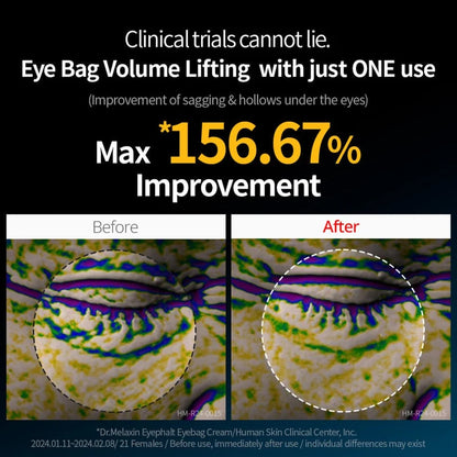 Dr Melaxin - Eyephalt Eyecream